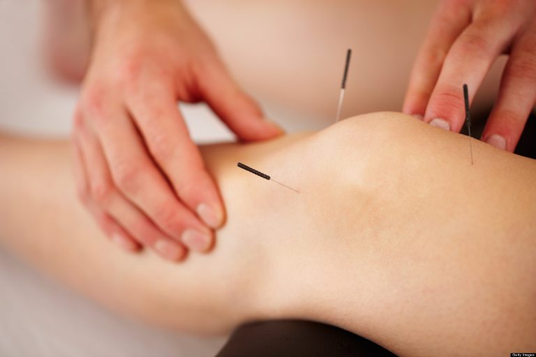 relief, tradiational, acupuncture, chinese medicine, health, healing, pain, skin, littlehampton, natural, LNHC, west sussex, littlehampton natural health centre