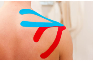 physiotherapy in littlehampton, physio, arundel, rustington, rehab, taping, acupuncture, physiotherapist, health centre